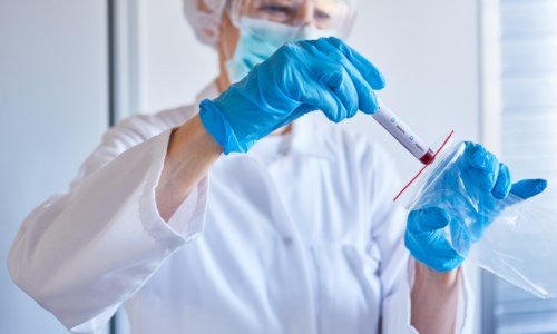 Emergenza pandemiaCovid, il Governo punta sui vaccini e non pensa a nuove restrizioni: non escluse strette solo per i no vax 
