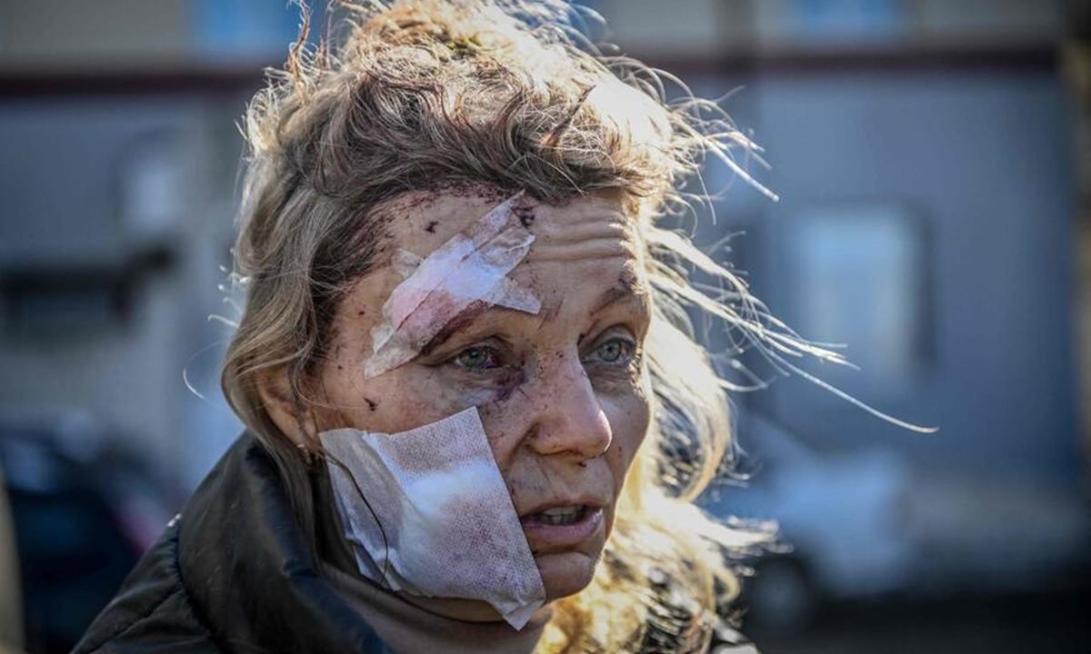 Una donna ucraina ferita nei bombardamenti (foto Ansa)