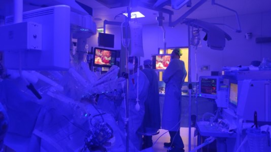 SanitàSi apre l’era della Chirurgia robotica anche all’ospedale Annunziata di Cosenza