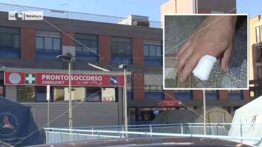 Il caso«Riattaccatemi il dito, presto»: ma in ospedale a Cosenza passa più di un’ora e l’indice va in necrosi