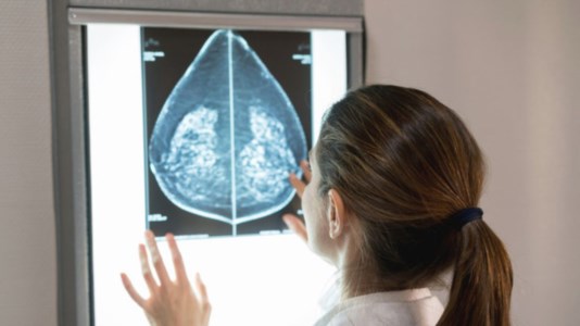 Screening del tumore al seno (Foto Ansa)