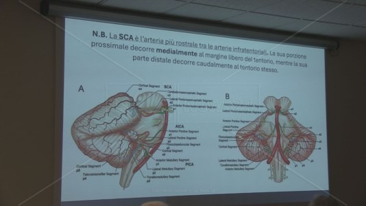 Il congressoCosenza, simposio sulla neuroanatomia: le eccellenze della neurochirurgia vascolare a confronto