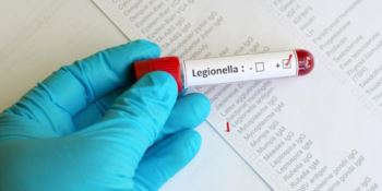 Legionella, morto il paziente ricoverato a Catanzaro